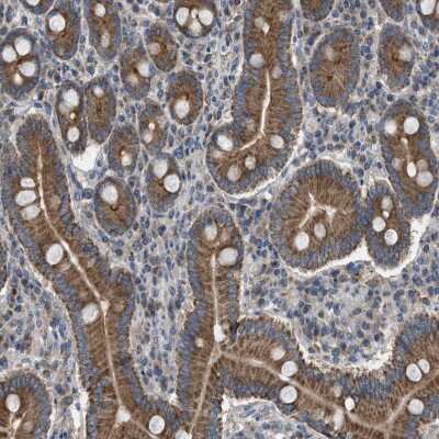 Immunohistochemistry TPK1 Antibody