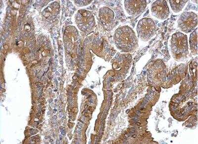 Immunohistochemistry-Paraffin: TPK1 Antibody [NBP1-32248] -  Paraffin-embedded mouse intestine. TPK1 antibody dilution: 1:500.