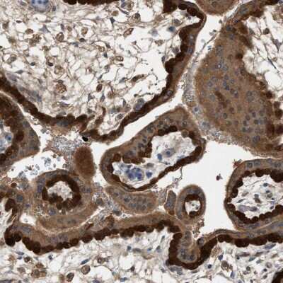 Immunohistochemistry-Paraffin: TPK1 Antibody [NBP1-83151] - Staining of human placenta shows strong cytoplasmic positivity in trophoblastic cells.