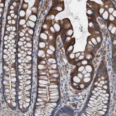 Immunohistochemistry-Paraffin: TPK1 Antibody [NBP1-83151] - Staining of human colon shows moderate to strong cytoplasmic positivity in glandular cells.