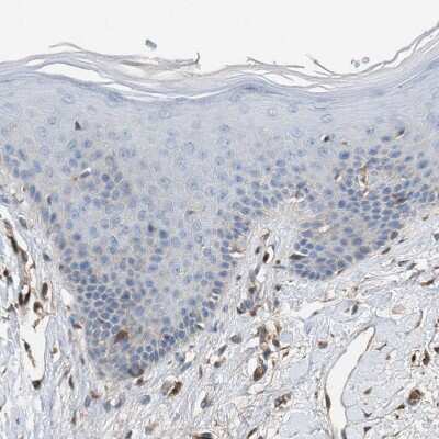 Immunohistochemistry-Paraffin: TPK1 Antibody [NBP1-83151] - Staining of human skin shows no positivity in squamous epithelial cells as expected.