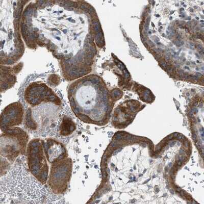 Immunohistochemistry-Paraffin: TPK1 Antibody [NBP1-83152] - Staining of human placenta shows strong cytoplasmic positivity in trophoblastic cells.