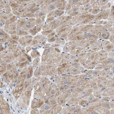 Immunohistochemistry-Paraffin: TPK1 Antibody [NBP1-83152] - Staining of human heart muscle shows moderate cytoplasmic positivity in myocytes.