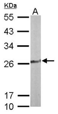 Western Blot: TPK1 Antibody [NBP1-32248] - Sample (50 ug of whole cell lysate) A: Mouse liver 12% SDS PAGE; antibody diluted at 1:1000.