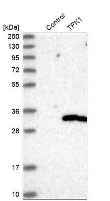 Western Blot TPK1 Antibody