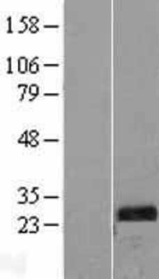 Western Blot: TPK1 Overexpression Lysate (Adult Normal) [NBL1-17218] Left-Empty vector transfected control cell lysate (HEK293 cell lysate); Right -Over-expression Lysate for TPK1.