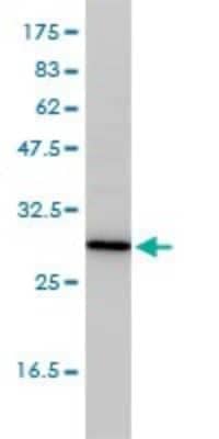 Western Blot: TPMT Antibody (1B5) [H00007172-M01] - TPMT monoclonal antibody (M01), clone 1B5 Analysis of TPMT expression in Jurkat.