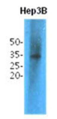 Western Blot: TPMT Antibody (2E7) [NBP1-97939] - The cell lysates (40ug) were resolved by SDS-PAGE, transferred to PVDF membrane and probed with anti-human TPMT antibody (1:1,000). Proteins were visualized using a goat anti-mouse secondary antibody conjugated to HRP and an ECL detection system.