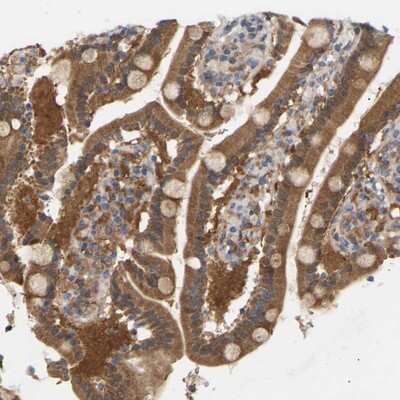 Immunohistochemistry-Paraffin: TPMT Antibody [NBP1-86032] - Staining of human duodenum shows strong cytoplasmic positivity in glandular cells.