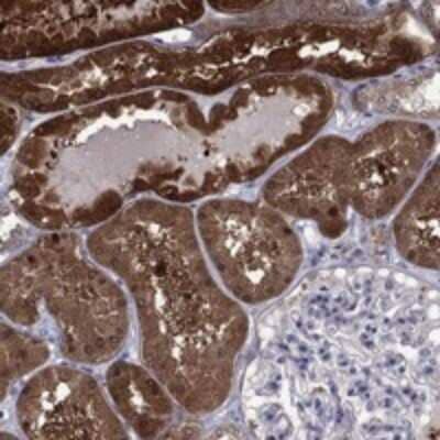 Immunohistochemistry-Paraffin: TPMT Antibody [NBP3-17776] - Staining of human kidney shows strong cytoplasmic positivity in cells in tubules.