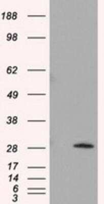 Western Blot: TPMT Antibody (OTI2A2) - Azide and BSA Free [NBP2-74570] - HEK293T cells were transfected with the pCMV6-ENTRY control (Left lane) or pCMV6-ENTRY TPMT (Right lane) cDNA for 48 hrs and lysed. Equivalent amounts of cell lysates (5 ug per lane) were separated by SDS-PAGE and immunoblotted with anti-TPMT.