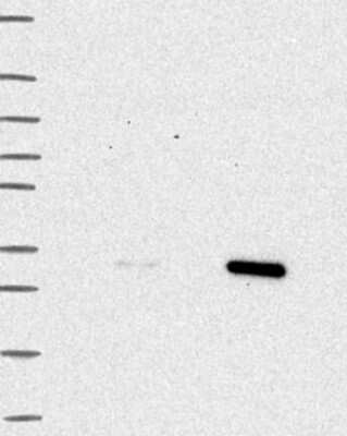 Western Blot: TPMT Antibody [NBP3-17776] - Lane 1: Marker [kDa] 250, 130, 95, 72, 55, 36, 28, 17, 10;   Lane 2: RT4;   Lane 3: U-251 MG;   Lane 4: Human Plasma;   Lane 5: Liver;   Lane 6: Tonsil