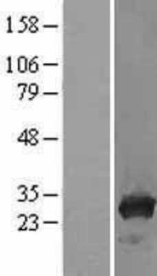 Western Blot: TPMT Overexpression Lysate (Adult Normal) [NBL1-17222] Left-Empty vector transfected control cell lysate (HEK293 cell lysate); Right -Over-expression Lysate for TPMT.