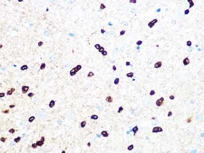 Immunohistochemistry-Paraffin: TPPP/p25 Antibody (3S5U9) [NBP3-16454] - Immunohistochemistry of paraffin-embedded rat brain using TPPP/p25 Rabbit mAb (NBP3-16454) at dilution of 1:100 (40x lens).Perform microwave antigen retrieval with 10 mM PBS buffer pH 7.2 before commencing with IHC staining protocol.