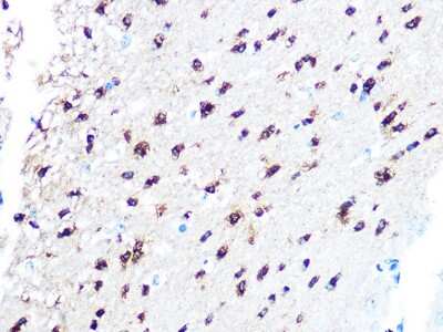 Immunohistochemistry-Paraffin: TPPP/p25 Antibody (3S5U9) [NBP3-16454] - Immunohistochemistry of paraffin-embedded mouse brain using TPPP/p25 Rabbit mAb (NBP3-16454) at dilution of 1:100 (40x lens).Perform microwave antigen retrieval with 10 mM PBS buffer pH 7.2 before commencing with IHC staining protocol.