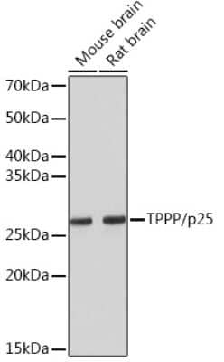 Western Blot: TPPP/p25 Antibody (3S5U9) [NBP3-16454] - Western blot analysis of extracts of various cell lines, using TPPP/p25 Rabbit mAb (NBP3-16454) at 1:5000 dilution. Secondary antibody: HRP Goat Anti-Rabbit IgG (H+L) at 1:10000 dilution. Lysates/proteins: 25ug per lane. Blocking buffer: 3% nonfat dry milk in TBST. Detection: ECL Basic Kit. Exposure time: 3min.