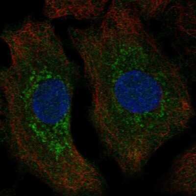 Immunocytochemistry/Immunofluorescence: TPPP/p25 Antibody [NBP2-34031] - Staining of human cell line A549 shows localization to cytosol & mitochondria. Antibody staining is shown in green.