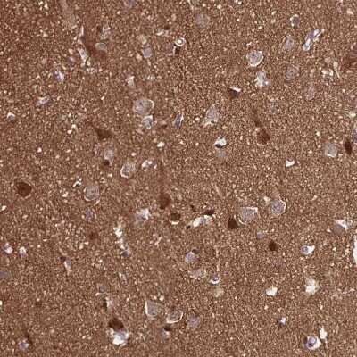 Immunohistochemistry-Paraffin: TPPP/p25 Antibody [NBP1-80962] - Staining of human cerebral cortex shows nuclear and cytoplasmic positivity in neurons.