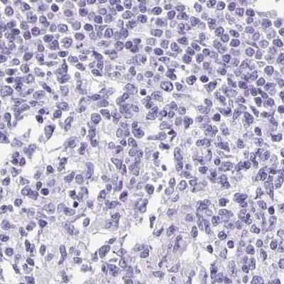 Immunohistochemistry-Paraffin: TPPP/p25 Antibody [NBP1-80962] - Staining of human lymph node.