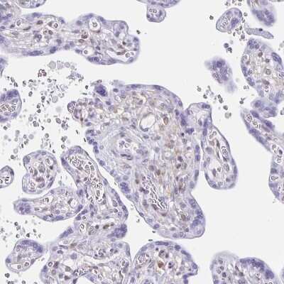 Immunohistochemistry-Paraffin: TPPP/p25 Antibody [NBP1-80962] - Staining of human placenta shows no positivity in trophoblastic cells and weak cytoplasmic and nuclear staining in Hofbauer cells.