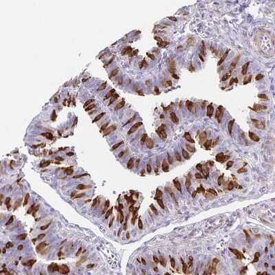 Immunohistochemistry-Paraffin: TPPP/p25 Antibody [NBP1-80962] - Staining of human fallopian tube shows cytoplasmic positivity in glandular cells.