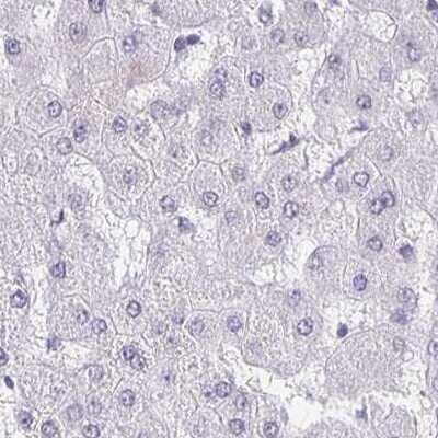 Immunohistochemistry-Paraffin: TPPP/p25 Antibody [NBP1-80962] - Staining of human liver.