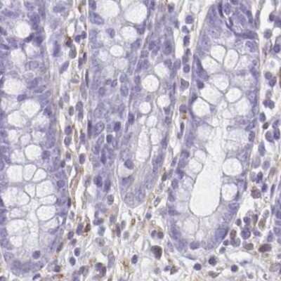 Immunohistochemistry-Paraffin: TPPP/p25 Antibody [NBP1-80962] - Staining of human colon.