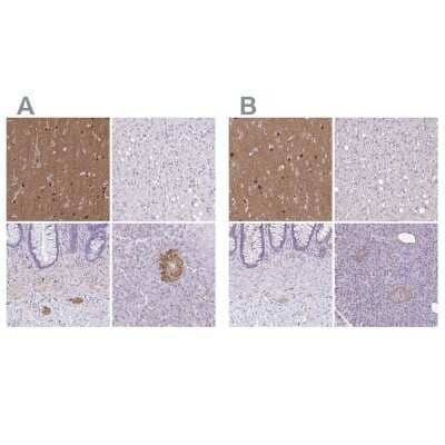 <b>Independent Antibodies Validation. </b>Immunohistochemistry-Paraffin: TPPP/p25 Antibody [NBP1-80962] - Staining of human cerebral cortex, liver, lower gastrointestinal and pancreas using Anti-TPPP antibody NBP1-80962 (A) shows similar protein distribution across tissues to independent antibody NBP2-34031 (B).