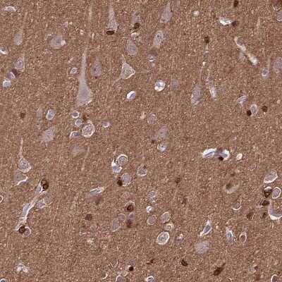 Immunohistochemistry-Paraffin: TPPP/p25 Antibody [NBP1-80962] - Staining of human cerebral cortex shows strong cytoplasmic and nuclear positivity in glial cells.