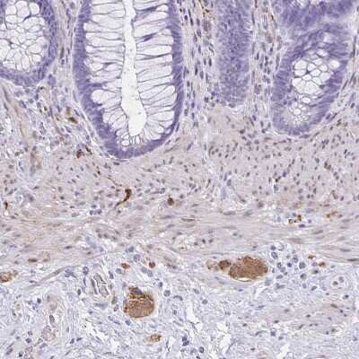 Immunohistochemistry-Paraffin: TPPP/p25 Antibody [NBP1-80962] - Staining of human lower gastrointestinal shows moderate cytoplasmic positivity in peripheral ganglion.