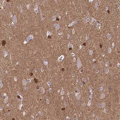 Immunohistochemistry-Paraffin: TPPP/p25 Antibody [NBP2-34031] - Staining of human cerebral cortex shows strong cytoplasmic and nuclear positivity in glial cells.