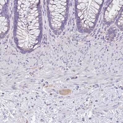 Immunohistochemistry-Paraffin: TPPP/p25 Antibody [NBP2-34031] - Staining of human lower gastrointestinal shows weak cytoplasmic positivity in peripheral ganglion.