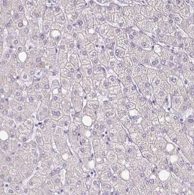 Immunohistochemistry-Paraffin: TPPP/p25 Antibody [NBP2-34031] - Staining of human liver shows no positivity in hepatocytes as expected.