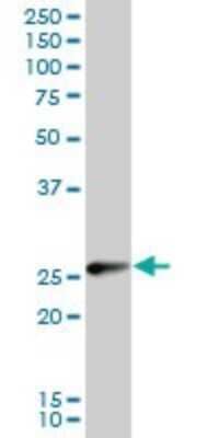 Western Blot: TPPP/p25 Antibody [H00011076-B01P] - Analysis of TPPP expression in rat brain.