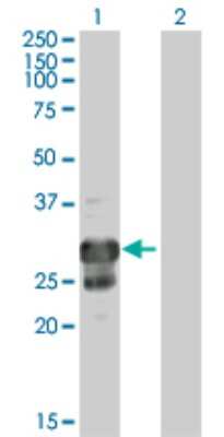 Western Blot: TPPP/p25 Antibody [H00011076-B01P] - Analysis of TPPP expression in transfected 293T cell line by TPPP polyclonal antibody.  Lane 1: TPPP transfected lysate(24.09 KDa). Lane 2: Non-transfected lysate.