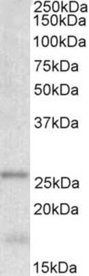 Western Blot: TPPP/p25 Antibody [NBP1-49833] - (0.001ug/ml) Analysis of Human Cerebellum lysate (35ug protein in RIPA buffer). Primary incubation was 1 hour. Detected by chemiluminescence.