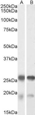 Western Blot: TPPP/p25 Antibody [NBP1-49833] - (0.001ug/ml) staining of Mouse (A) and Rat (B) Brain lysate (35ug protein in RIPA buffer). Primary incubation was 1 hour. Detected by chemiluminescence