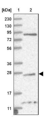 Western Blot: TPPP/p25 Antibody [NBP1-80962] - Lane 1: Marker  [kDa] 230, 130, 95, 72, 56, 36, 28, 17, 11.  Lane 2: Human cell line RT-592