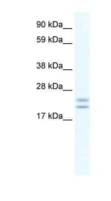 Western Blot: TPPP/p25 Antibody [NBP1-91613] - Human Frontal Cortex lysate, concentration 0.625ug/ml.