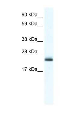 Western Blot: TPPP/p25 Antibody [NBP1-91614] - Titration: 1.25ug/ml, Positive Control: Human brain.