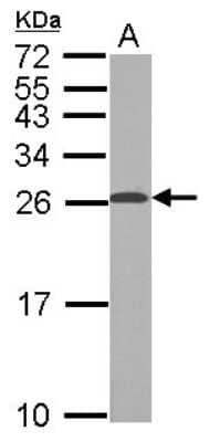 Western Blot: TPPP/p25 Antibody [NBP2-20688] - Sample (50 ug of whole cell lysate) A: Mouse Brain, 12% SDS PAGE gel, diluted at 1:1000.