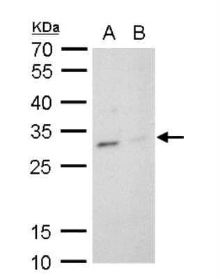 Western Blot: TPPP/p25 Antibody [NBP2-20688] - A. 30 ug PC-12 whole cell lysate/extract B. 30 ug Rat2 whole cell lysate/extract 12 % SDS-PAGE TPPP antibody  dilution: 1:20000