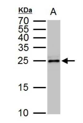 Western Blot: TPPP/p25 Antibody [NBP2-20688] - A. 50 ug rat brain lysate/extract 15 % SDS-PAGETPPP antibody dilution: 1:1000