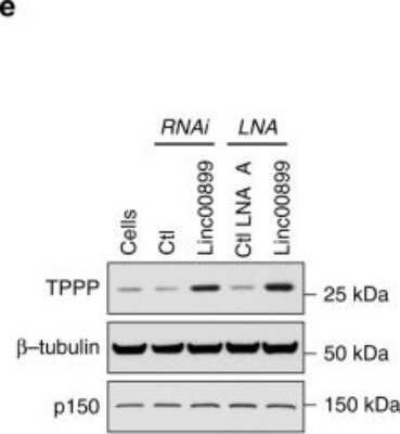 <b>Biological Strategies Validation. </b>Western Blot: TPPP/p25 Antibody [NBP2-34031] - TPPP/p25, a microtubule-stabilising protein, is a target of linc00899 in regulation of mitosis. Representative western blot of TPPP/p25 levels after depletion of linc00899. beta-Tubulin and p150 were used as two loading controls. Image collected and cropped by CiteAb from the following publication (//www.nature.com/articles/s41467-020-14978-7), licensed under a CC-BY license.