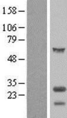 Western Blot: TPPP/p25 Overexpression Lysate (Adult Normal) [NBP2-10387] Left-Empty vector transfected control cell lysate (HEK293 cell lysate); Right -Over-expression Lysate for TPPP/p25.