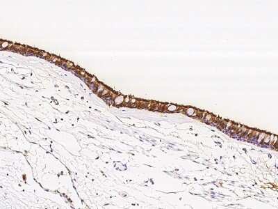 Immunohistochemistry-Paraffin TPPP2 Antibody - BSA Free