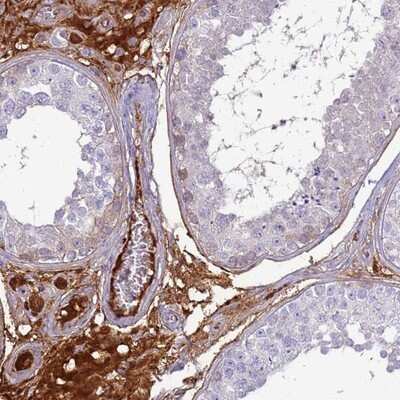 Immunohistochemistry-Paraffin: TPPP3 Antibody [NBP2-13469] - Staining of human testis shows strong cytoplasmic positivity in Leydig cells.