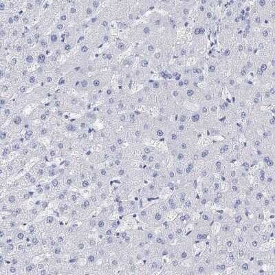 Immunohistochemistry-Paraffin: TPPP3 Antibody [NBP3-17045] - Staining of human liver shows low expression as expected.