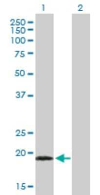 Western Blot: TPPP3 Antibody [H00051673-B02P] - Analysis of TPPP3 expression in transfected 293T cell line by TPPP3 polyclonal antibody.  Lane 1: TPPP3 transfected lysate(19.00 KDa). Lane 2: Non-transfected lysate.