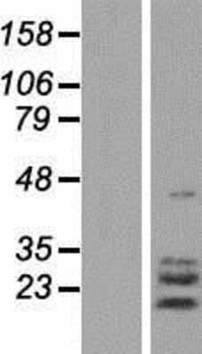 Western Blot TPPP3 Overexpression Lysate